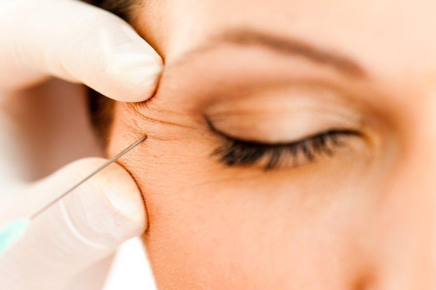 Female patient model getting injected with a needle close to the eye