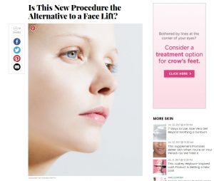 Is This New Procedure the Alternative to a Face Lift?